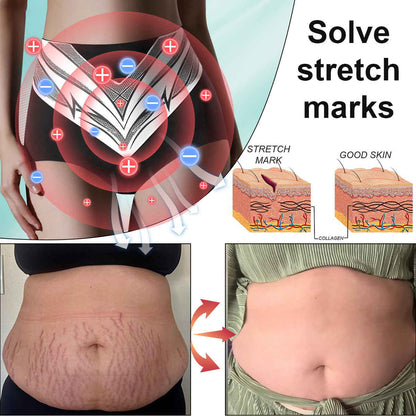 Glossy™ Titanium Fiber Self-heating Tourmaline Shaping Shorts 💙