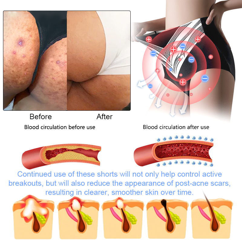 Glossy™ Titanium Fiber Self-heating Tourmaline Shaping Shorts 💙