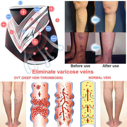 Glossy™ Titanium Fiber Self-heating Tourmaline Shaping Shorts 💙