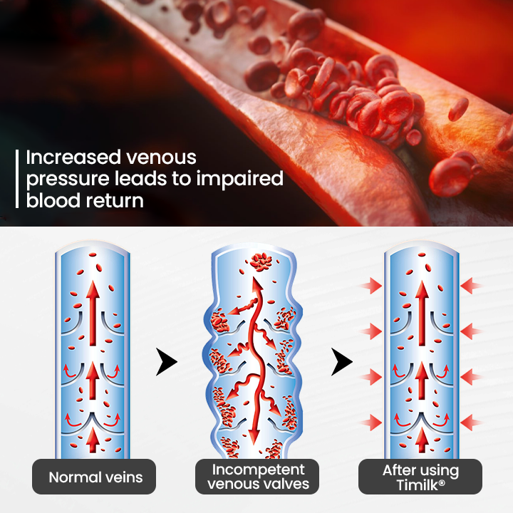 glossy™ Leg Vein Magnet Ankle Bracelet