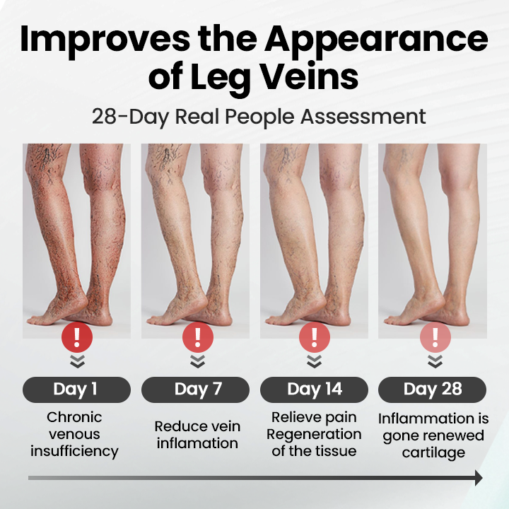 glossy™ Leg Vein Magnet Ankle Bracelet