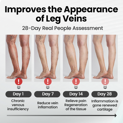 glossy™ Leg Vein Magnet Ankle Bracelet