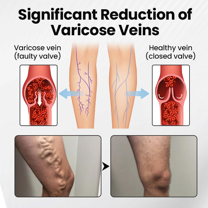 glossy™ Leg Vein Magnet Ankle Bracelet