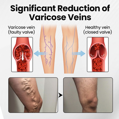 glossy™ Leg Vein Magnet Ankle Bracelet