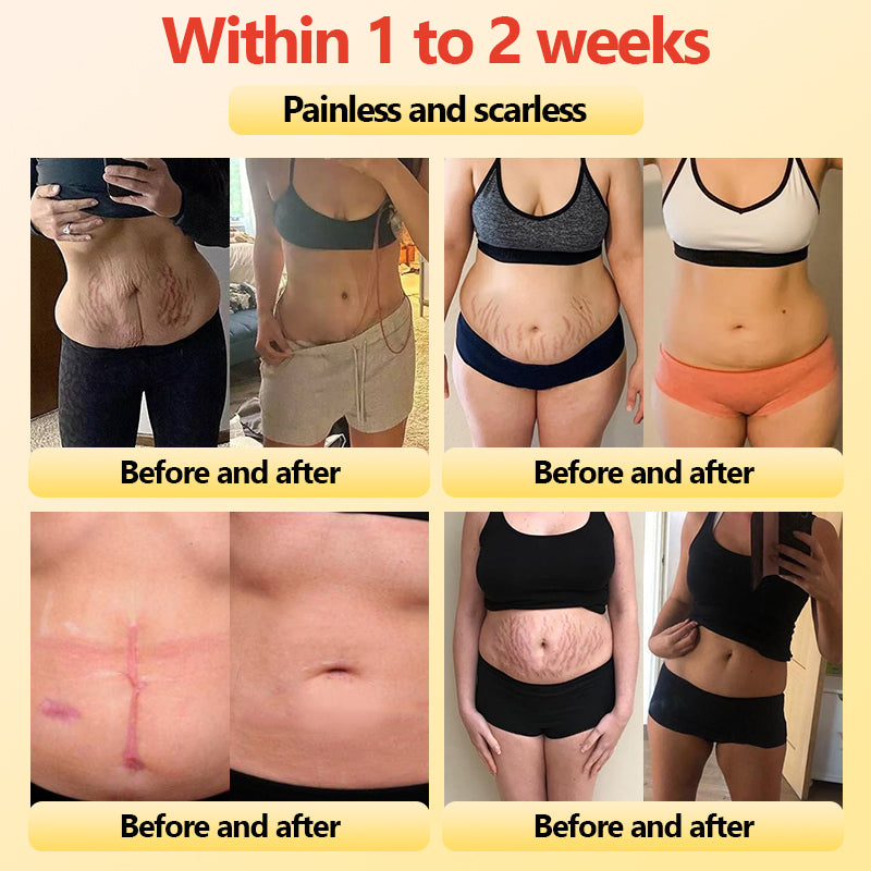 Glossy™ Titanium Fiber Self-heating Tourmaline Shaping Shorts 💙