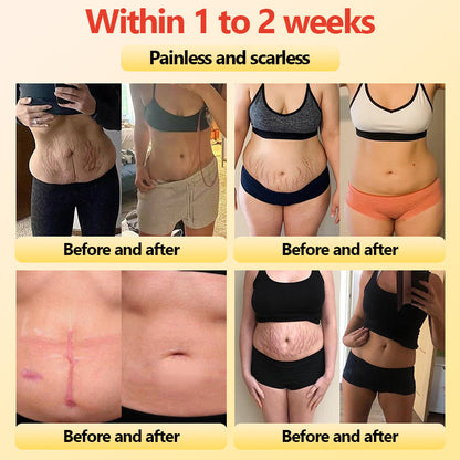 Glossy™ Titanium Fiber Self-heating Tourmaline Shaping Shorts 💙